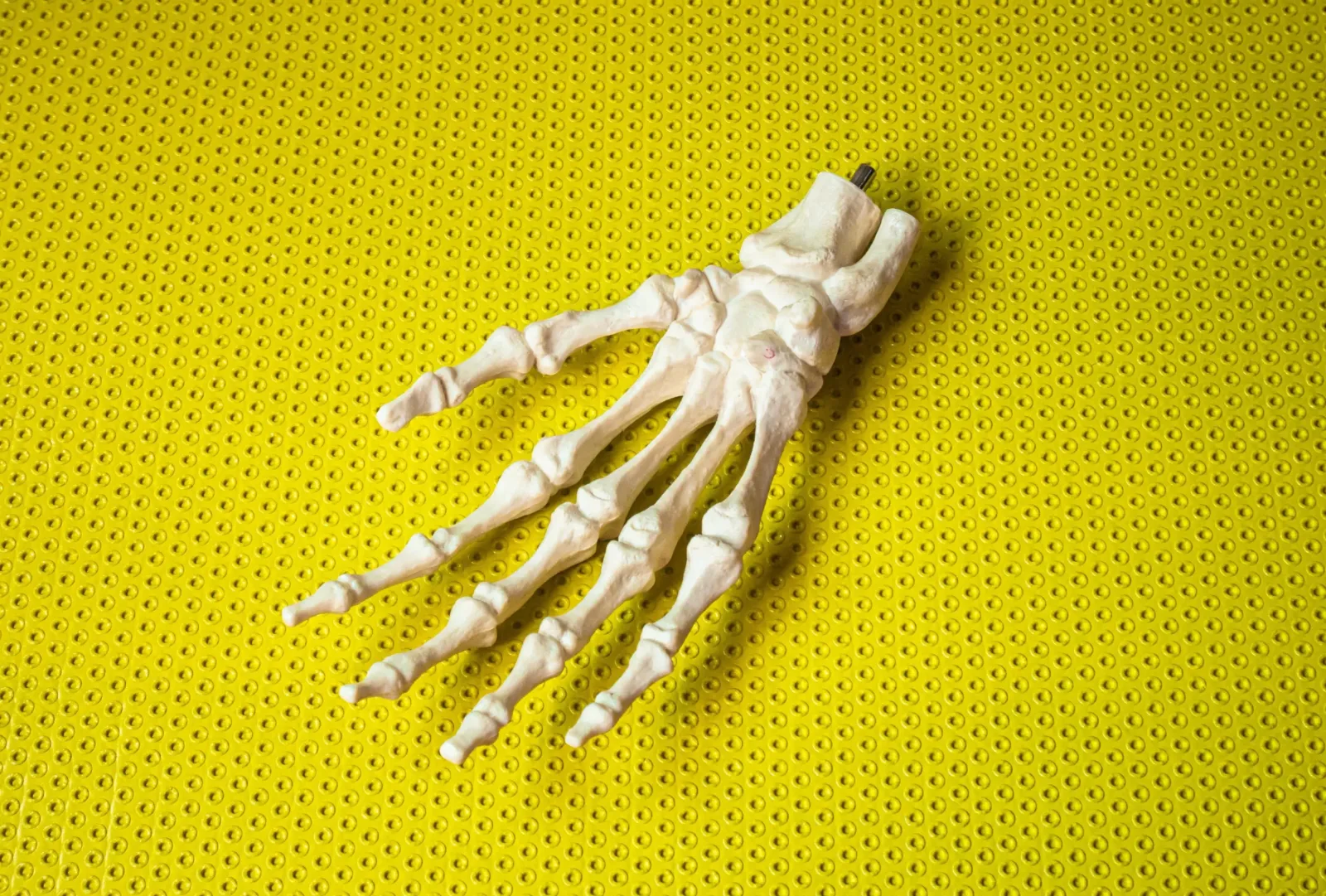 Orthopedics in Turkey