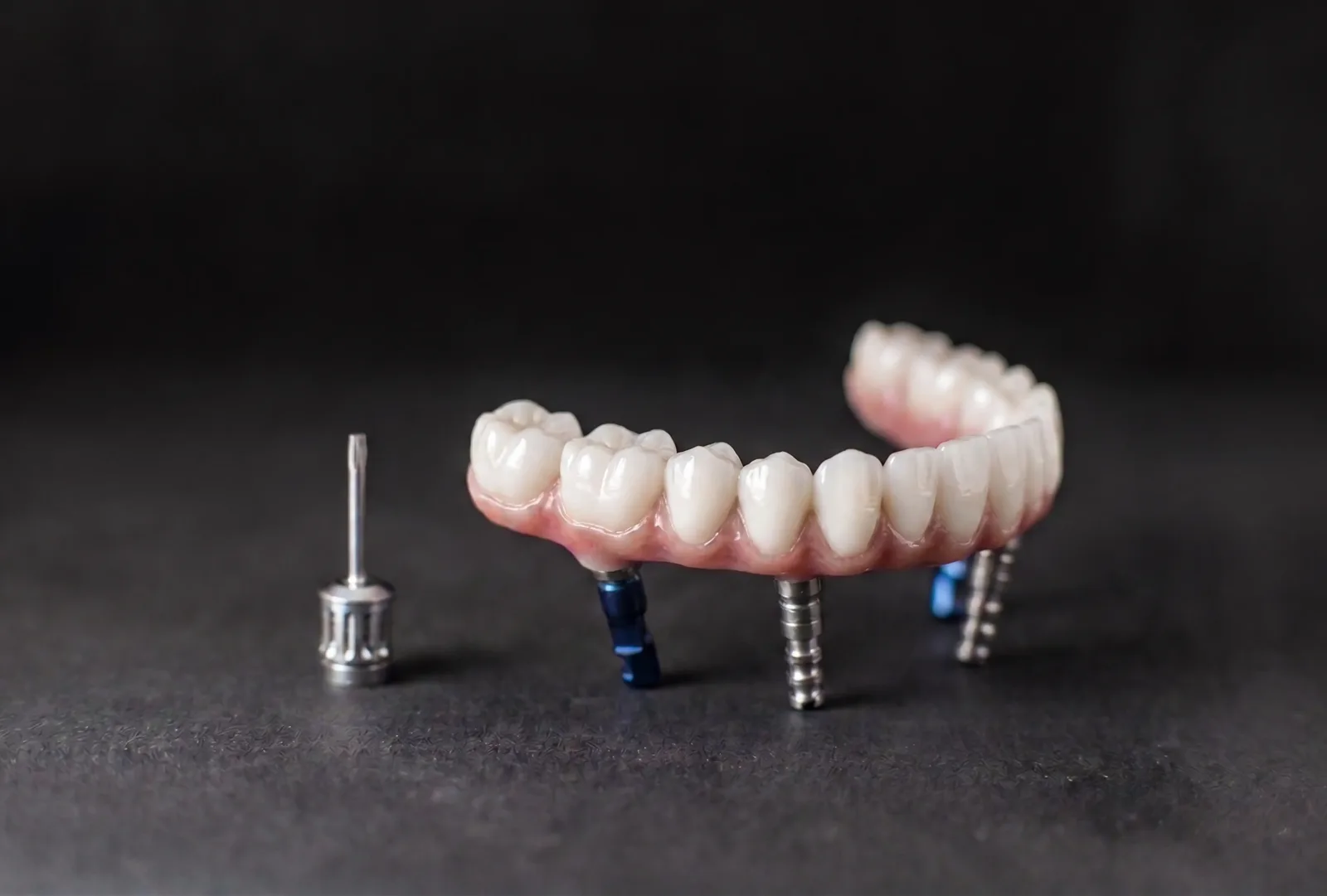 All-on-4 Dental Implants in Turkey