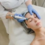 mesotherapy