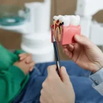 root-canal-reatment