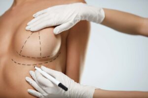 Breast Lift Turkey: Is it Worth it?