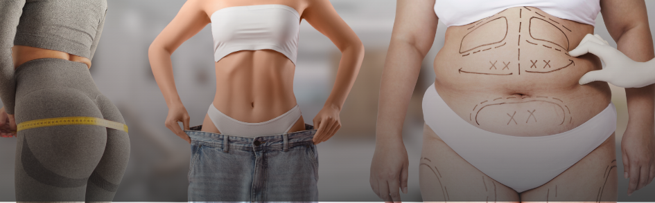 Операции по снижению веса