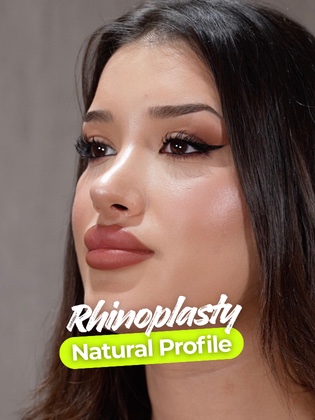 Social Media Youtube & Instagram