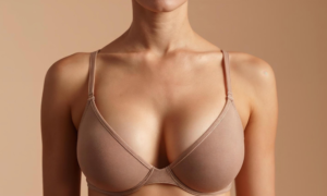Breast Implants (Breast Augmentation Surgery)