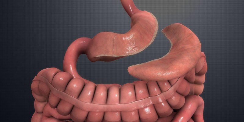 Gastric Sleeve (Sleeve Gastrectomy)