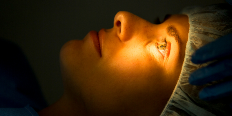 LASIK (Laser-Assisted in Situ Keratomileusis)