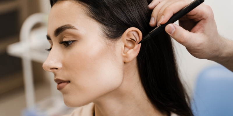 Otoplasty (Ear Reshaping Surgery)